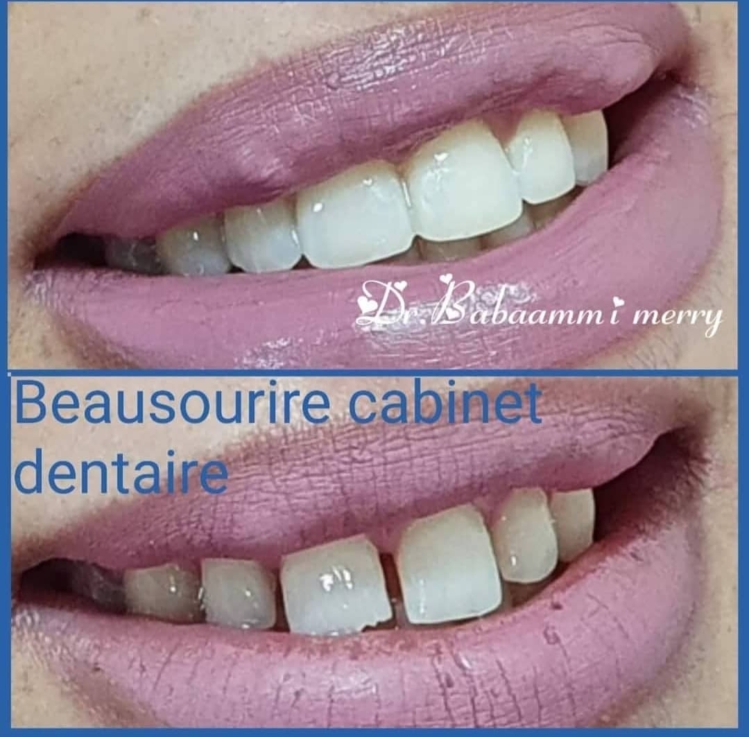 Éclat naturel retrouvé — Réhabilitation de la teinte et de la brillance